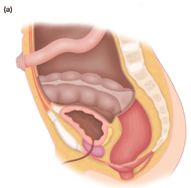 Bailey and Love's Short Practice of Surgery 28th Edition