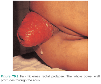 Bailey and Love's Short Practice of Surgery 28th Edition