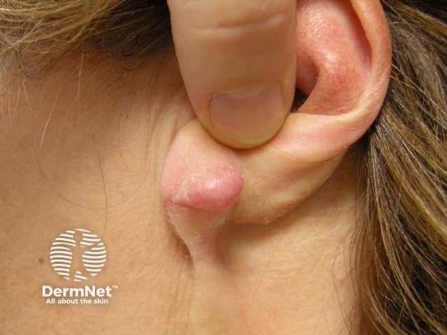 Dermnetnz