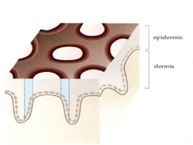 This image is a high-level educational illustration illustrating the layered structure of human skin. Modalities: schematic diagram; Anatomical location: integumentary system, cutaneous skin; The figure demonstrates the epidermis on the exterior and the underlying dermis, highlighting the epidermal-dermal junction and the wavy interface that forms dermal papillae. The epidermis is depicted as a stratified squamous epithelium with a pebbled appearance, while the dermis below shows connective tissue with dotted outlines suggesting collagen fibers and vascularized support. The cross-sectional perspective emphasizes tissue organization, basement membrane, and the boundary between the two layers. Although not a diagnostic imaging study, the depiction is valuable for education, illustrating normal architecture, cellular arrangement, and structural relationships that underlie wound healing and dermatopathology. This visualization assists learners to relate clinical features, biopsy findings, and histology slides, and it supports radiologic correlation in broader teaching contexts. It is particularly useful for medical students, residents, and allied health trainees seeking clear references for epidermal thickness, rete ridges, and dermal papillae; foundational for dermatology, pathology, and histology curricula. This description aids comparative anatomy studies, biopsy interpretation practice, and patient education resources by clarifying normal skin layering, junctional zones, and the relative depth of epidermal layers today.