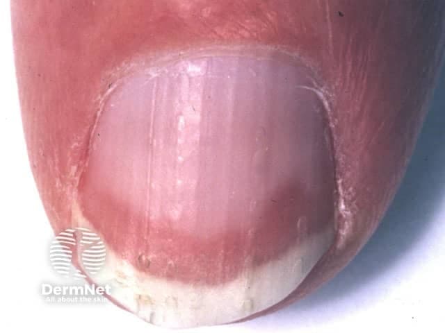 Dermnetnz