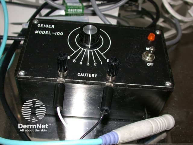 This image is a clinical photograph of an electrosurgical unit (electrocautery generator) used for cauterization and hemostasis during dermatologic or minor surgical procedures. It shows a front/anterolateral view of a portable black metal box labeled Geiger Model-100, with a large central dial and two rocker-style control knobs. The central knob is surrounded by white indicator lines, suggesting adjustable energy output. The panel bears the words CAUTION and CAUTERY, plus an ON/OFF switch with an orange status light, indicating power to the device. Two insulated handpiece leads exit the front lower panel, each connected to individual connectors; color-coded cables (blue/white) and a separate large-diameter connector likely attach to patient-side active electrodes or grounding pads, consistent with monopolar or bipolar configurations. The unit appears designed for dermatosurgical use in a clinic or operating room. The dial markings range from 2 to 8, implying variable power or waveform settings; the central control suggests adjustment of current, voltage, and pulse mode. This photograph emphasizes equipment literacy, safety labeling, and ergonomic arrangement of the unit for rapid activation during procedures. Relevance: educational reference for medical students, residents, nurses, and technicians to recognize electrocautery apparatus, standard labeling, energy-control interfaces, and to discuss device-safe operation, energy settings, and potential complications such as thermal injury or unintended burns.