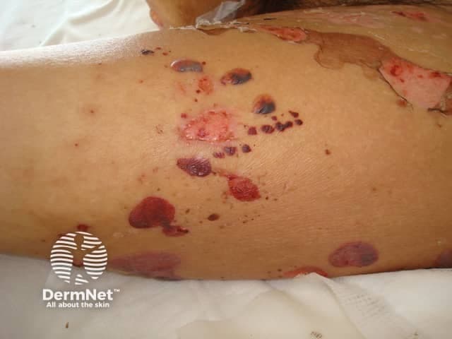 Dermnetnz