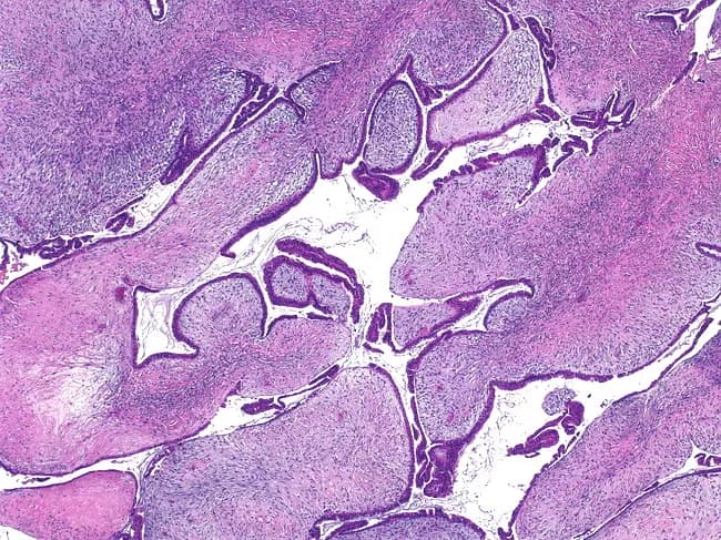 webpathology