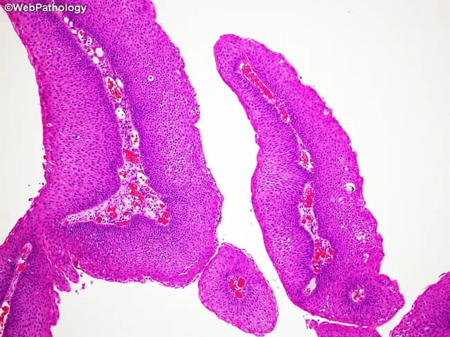 High-resolution bright-field histology image of gastrointestinal mucosa stained with hematoxylin and eosin (H&E). The specimen is a small intestinal biopsy or mucosal patch showing tall finger-like villi with slender, bulbous cores of lamina propria and a lined epithelium. The tissue architecture emphasizes the mucosal surface with exuberant villous projections, smooth luminal interface, and intact surface epithelium. Hematoxylin stains nuclei a deep blue, while eosin imparts pink–red cytoplasmic and extracellular matrix contrast, highlighting enterocyte basophilic nuclei, goblet cells, and vascular channels within the lamina propria. Goblet cells appear as pale, mucus-filled pockets along the villus stalks. There is no obvious villous blunting, crypt hyperplasia, inflammatory infiltrate, or architectural distortion evident in this field. The image demonstrates features typical of normal or near-normal small intestinal mucosa, displaying orderly cellular polarity and well-differentiated enterocytes. Clinically, this pattern is relevant for differential diagnosis of malabsorption syndromes, celiac disease, infectious enteritis, and inflammatory bowel conditions, where villous atrophy, crypt hyperplasia, or inflammatory infiltration would be expected. The slide is suitable for educational reference, histology teaching, and comparative pathology, providing a baseline for recognizing standard villous architecture in gastrointestinal mucosa and for contrast with pathological specimens. This image supports educational objectives in anatomy, histology, and diagnostics.