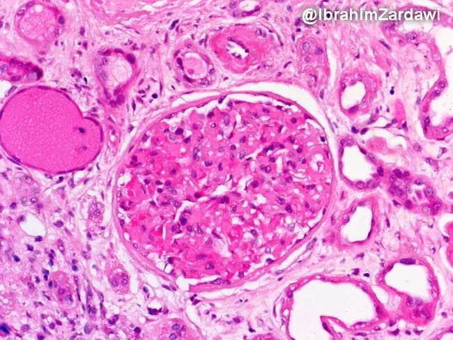 webpathology