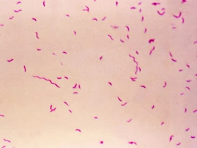 Bright-field light microscopy of a Gram-stained bacterial smear reveals numerous small, slender, curved Gram-negative rods with a characteristic gull-wing appearance consistent with Campylobacter species. The image captures bacteria oriented individually and in small clusters against a pale pink counterstain, illustrating Bacillary morphology typical of enteric pathogens. Gram staining shows purple/blue rods (crystal violet retained by cell wall) with a light pink background from the counterstain (safranin), enabling discrimination from Gram-positive organisms. The organisms appear slender and curved, with a single polar flagellum suggested by motility or alignment in the smear. Specimen type is a bacterial smear obtained from a gastrointestinal sample (feces or culture isolate), prepared for diagnostic microbiology. The imaging modality is bright-field microscopy at high magnification (approximately 1000x with oil immersion), following Gram staining to highlight bacterial cell wall structure. Clinically, detection of Campylobacter species supports infectious gastroenteritis; in the IPSID (immunoproliferative small intestinal disease) context, Campylobacter involvement has been proposed as a pathogenic trigger mirroring Helicobacter pylori's role in gastric MALT lymphoma. Differential diagnoses include Helicobacter, Vibrio, and other curved Gram-negative bacteria. This image serves educational and diagnostic utility for microbiology, clinical pathology, gastroenterology, and infectious disease research.