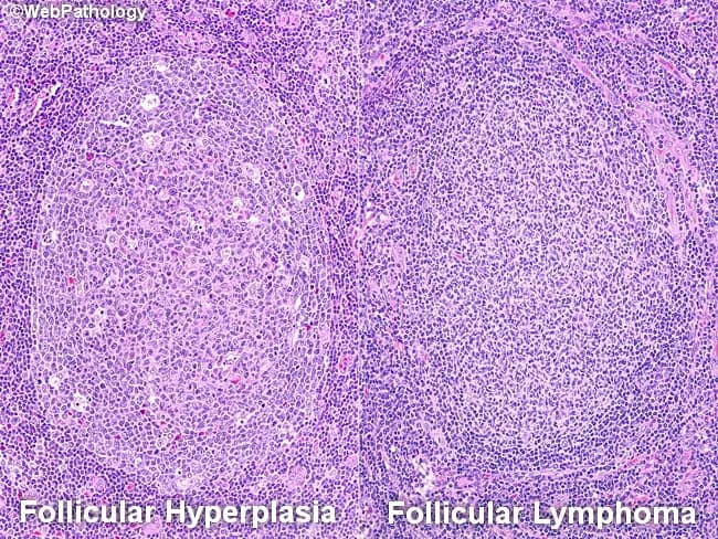webpathology