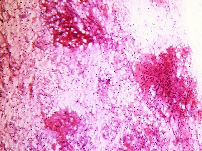 webpathology