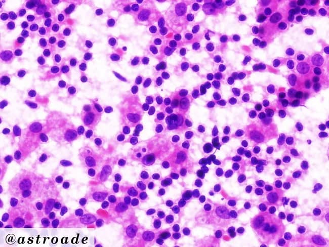 webpathology