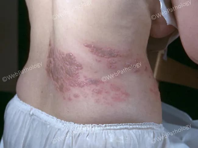 webpathology