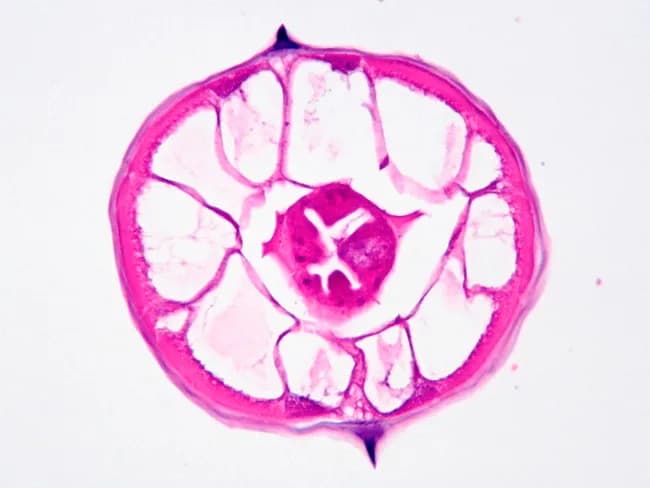 This image illustrates a transverse cross-section of Enterobius vermicularis (pinworm) captured by bright-field light microscopy after routine histological staining. The specimen is a nematode cuticle with a thick, pink-stained epidermal syncytial layer and underlying hypodermis, surrounding a central pseudocoel containing the alimentary canal. The outer surface displays characteristic longitudinal ridges (alae) along the body, which are highly diagnostic for E. vermicularis and help distinguish it from other intestinal nematodes. In this transverse section, the circular muscle layer and surrounding tissues are visible as concentric bands; the central intestinal cavity may appear as a variably stained lumen. The cuticle shows a defined border with folds that contribute to the worm’s distinctive morphology. The staining highlights the structural organization of nematode body wall, sensory and digestive components, and the internal organ arrangement, including dorsal and ventral nerve cords and radial musculature. Clinically, identification of these lateral alae in parasite sections supports a diagnosis of enterobiasis, particularly when correlated with patient symptoms such as perianal itching and epidemiologic context. This image is valuable for parasitology education, histopathology teaching, and differential diagnosis of intestinal nematodes in biopsy or stool preparation. Additional clinical relevance includes parasite burden assessment and educational demonstrations for students in pathology.