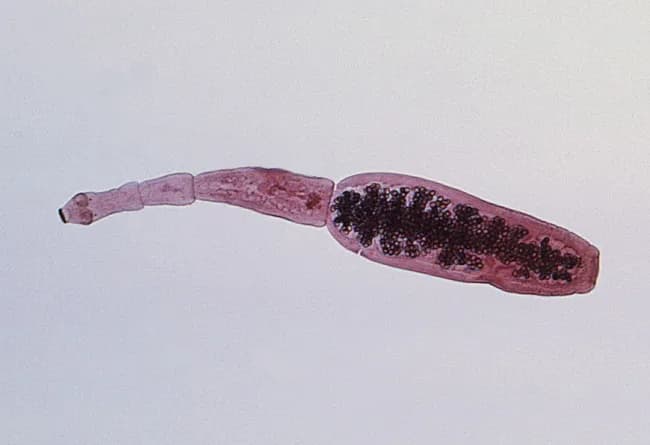 This image is a macroscopic photomicrograph of an adult cestode segment consistent with Echinococcus granulosus, the dog tapeworm. The specimen length is about 3–6 mm and shows a defined scolex with four suckers and a rostellum bearing 25–50 hooks, a classic genus-defining feature. Behind the scolex, three proglottids are visible, with the terminal proglottid gravid and longer than wide, indicating mature sexual production. The gravid segment contains densely packed eggs, visible as numerous dark structures within the proglottid. Morphology supports genus-level identification and differentiation from Taenia species in educational and diagnostic settings. Echinococcus spp. have a life cycle requiring dogs or other canids as definitive hosts and intermediate hosts such as sheep or cattle; humans become accidental intermediate hosts after ingesting eggs, leading to hydatid disease via larval cyst formation mostly in the liver, lungs, or CNS. In veterinary and medical contexts, this image aids teaching parasitology, veterinary parasitology, zoonotic risk assessment, and public health strategies—dog deworming, hygiene, and prevention of fecal contamination. Image courtesy of CDC/Dr. Peter M. Schantz.