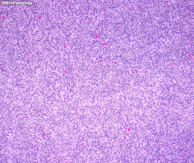 webpathology