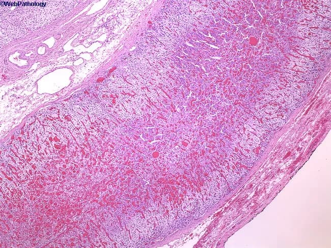 This histology image depicts a low-power hematoxylin-eosin stained cross-section of the mammalian adrenal gland, showing the capsule and the steroidogenic cortex with its three distinct zonal architectures. The adrenal cortex comprises approximately 90% of the gland and is organized into zona glomerulosa (outermost), zona fasciculata (widest middle layer), and zona reticularis (inner zone) adjacent to the medulla. The cortex appears pale and vesiculated due to lipid-rich, foamy cytoplasm within steroid-producing cells, arranged in cords and fascicles separated by sinusoids. At this low magnification, the boundary between capsule and cortex is evident, although a detailed medullary region is not fully resolved. The image demonstrates normal cortical histology without overt neoplasia, hemorrhage, or fibrosis. The adrenal cortex synthesizes glucocorticoids, mineralocorticoids, and androgens under ACTH regulation, with zonation reflecting functional segregation: zona glomerulosa producing aldosterone, zona fasciculata secreting cortisol, and zona reticularis generating dehydroepiandrosterone. Clinically, this pattern is essential for understanding endocrine physiology and adrenal disorders. This composite image serves educational reference for histology, pathology, and medical education, enabling comparison to hyperplasia, adenomas, or pheochromocytoma in other sections. The slide illustrates capsule integrity, distinct cortical zones, and ordinary vascular architecture relevant to teaching. Useful for exams, case discussions, and comparative pathology analyses exercises.