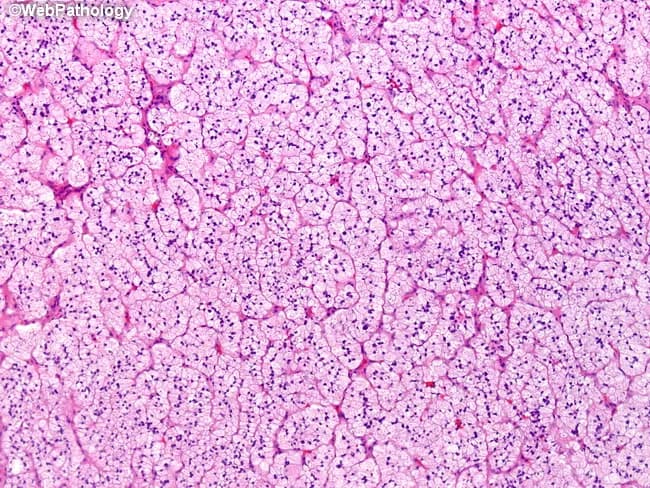 A high-resolution light microscopy image of lung parenchyma stained with hematoxylin and eosin. The tissue section exposes multiple pulmonary alveoli arranged in thin-walled saccules separated by delicate interalveolar septa. Alveolar spaces appear largely air-filled with minimal intra-alveolar material; capillary networks are present within septa, giving a fine reticular background. Type I pneumocytes line most alveolar surfaces with flat morphology, while occasional cuboidal type II pneumocytes are visible along septal borders. The alveolar septa show sparse cellularity and no conspicuous inflammatory infiltrate. There is no evidence of edema, hemorrhage, fibrosis, or hyaline membrane formation, and the overall architecture remains preserved without architectural distortion typical of fibrotic diseases. The stain highlights subtle nuclear detail in resident macrophages and endothelial cells, enabling evaluation of cellular morphology at this magnification. This image represents normal or non-pathologic pulmonary parenchyma, suitable as a reference for educational comparisons or as a control in studies of diffuse lung disease. Clinically, it serves as baseline histology against which interstitial lung diseases, edema, pneumonia, edema and alveolar proteinosis can be contrasted. Potential research use cases include training in normal alveolar histology, differential diagnosis workshops, and digital pathology algorithm development for tissue classification.