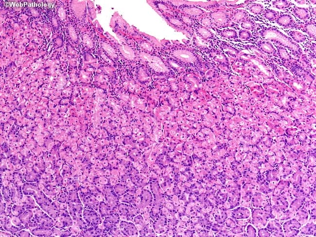 This is a bright-field light microscopy image of fixed gastric mucosa section stained with Hematoxylin and Eosin (H&E). The tissue shows gastric pits with an isthmus and neck populated by conspicuous parietal (oxyntic) cells with abundant eosinophilic cytoplasm and central nuclei. Parietal cells secrete hydrochloric acid and intrinsic factor, essential for digestion and B12 absorption. Deeper in the gland, chief (peptic) cells possess basophilic cytoplasm and secrete pepsinogen. Interspersed neuroendocrine cells release hormones; a stem cell zone resides at the neck, supporting constant epithelial renewal. The overall architecture corresponds to fundic-type oxyntic mucosa with tubular glands arranged in distinct isthmus/neck and base compartments. No overt inflammatory infiltrate or architectural distortion is evident, consistent with normal histology. This image is valuable for teaching gastric histology, differentiating mucous neck cells, parietal cells, chief cells, enteroendocrine cells, and stem cell niches, and for contextualizing pathologies affecting acid secretion, intrinsic factor production, or gastric carcinogenesis in educational and research settings.