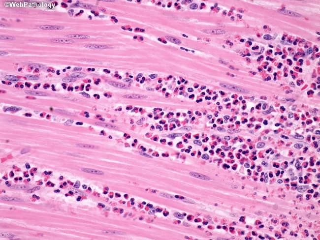 webpathology