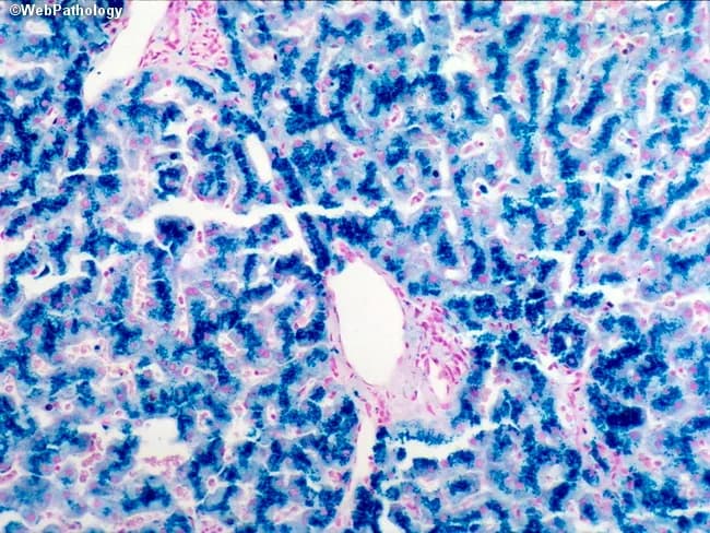 webpathology