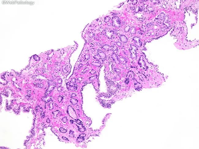 webpathology