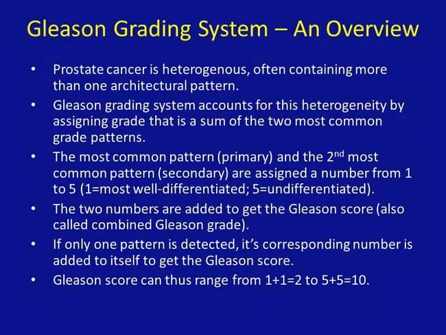 Imaging modality: Not applicable; this is an educational infographic illustrating the Gleason Grading System for prostate cancer. Primary subject: Gleason grading; Prostate gland tissue; histopathology overview. The figure explains that prostate adenocarcinoma is graded by two most prevalent architectural patterns observed in needle core biopsy or prostatectomy specimens. Patterns are numbered 1 through 5, with 1 being well differentiated (well-formed glands) and 5 being undifferentiated. The most common pattern (primary) and the second most common pattern (secondary) are assigned numbers and added to produce the Gleason score (e.g., 3+4 = 7; also called combined Gleason grade). If only a single pattern is detected, that pattern is summed with itself to yield the score (e.g., 3+3 = 6). The final score ranges from 2 to 10 in older definitions but commonly reported as 6 to 10 in modern practice, with higher scores indicating more aggressive disease. The diagnostic significance lies in prognosis and treatment planning; higher scores correlate with worse prognosis and may prompt intensified therapy, surveillance strategies, or risk stratification. Clinically, Gleason grading is integrated with PSA levels and imaging findings to guide biopsy decisions, active surveillance versus definitive therapy, and eligibility for systemic treatment. This framework supports educational, research, and clinical decision scenarios, including risk-adapted management, stratification into low-, intermediate-, and high-risk groups, and comparative pathology teaching for learners globally.