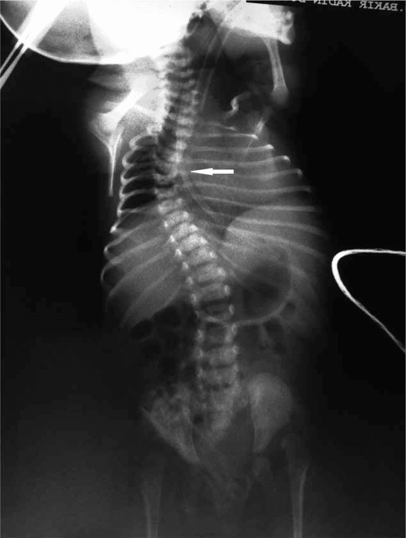 Hugging Face ROCO-Radiology
