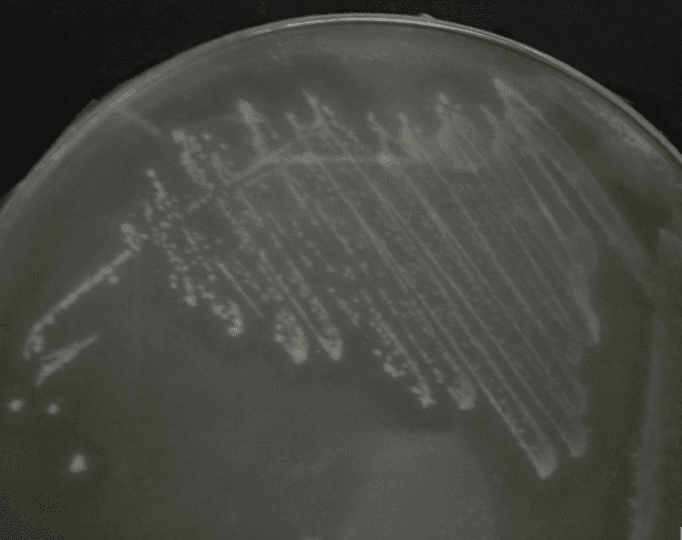 **Imaging Modality:** Laboratory photograph of a microbiological culture on an agar plate.

**Anatomical/Biological Entity:** Bacterial culture of *Cedecea neteri* (strain SSMD04).

**Observed Pathology/Phenotype:** The image displays bacterial colonies streaked onto a specialized agar medium supplemented with 0.5% corn oil. The primary diagnostic feature is the presence of distinct "halo" zones (zones of clearance or precipitation) surrounding the bacterial growth.

**Characteristic Visual Features:**
*   **Colony Morphology:** Small, circular, opaque white to light-gray colonies distributed along streak lines.
*   **Enzymatic Activity:** Clear translucency or a discernible halo effect in the agar adjacent to the colonies, indicative of extracellular lipase activity and lipid hydrolysis.
*   **Growth Pattern:** Standard quadrant streaking technique used to isolate individual colonies.

**Diagnostic Significance:** This biochemical assay demonstrates the metabolic capability of *C. neteri* to utilize lipids as a carbon source. The visible halo serves as a positive indicator for lipase production, a key phenotypic trait used in microbial classification and the study of bacterial virulence or industrial potential.