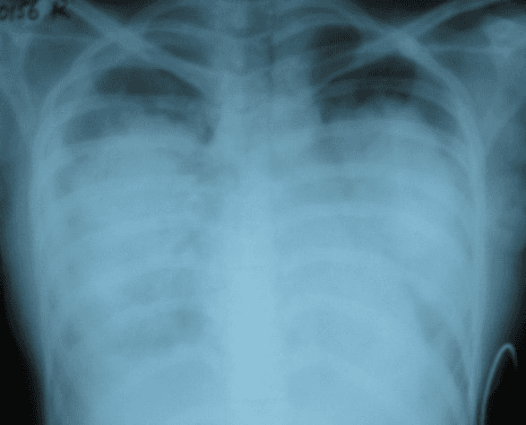 Hugging Face ROCO-Radiology