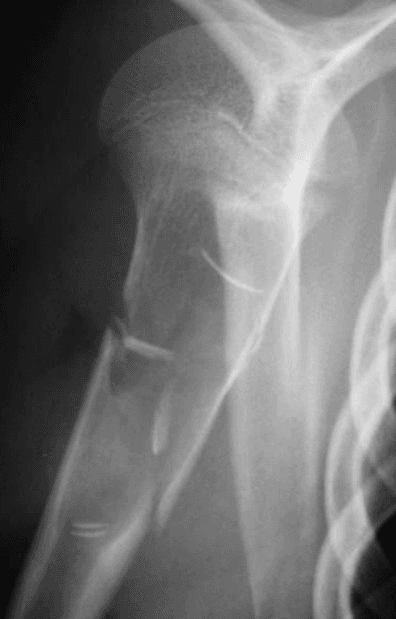 Hugging Face ROCO-Radiology