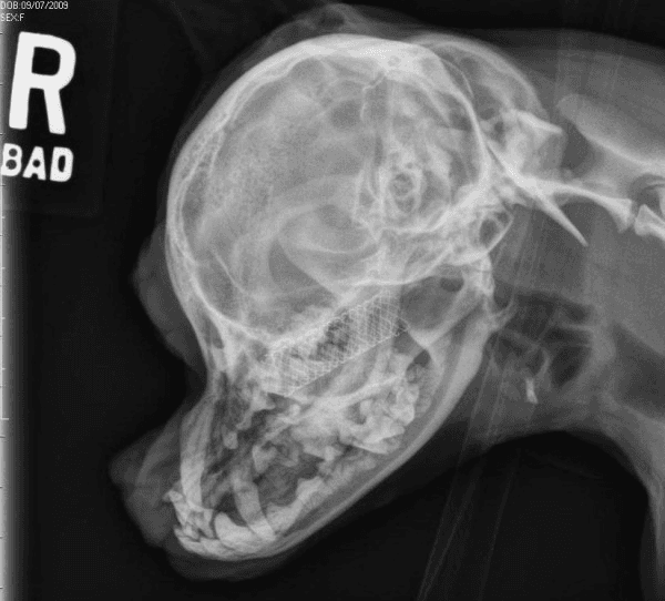 **Imaging Modality:** Veterinary diagnostic radiography (X-ray).

**Anatomical Region:** Lateral view of a canine skull (brachycephalic conformation).

**Observed Pathology/Intervention:** A radiopaque, metallic, self-expanding mesh stent is visible within the nasopharyngeal or nasal cavity region. The stent is cylindrical with a crisscross lattice pattern, positioned dorsal to the hard palate and extending caudally toward the nasopharynx.

**Characteristic Visual Features:**
*   **Skeletal Structures:** The skull demonstrates characteristic brachycephalic features, including a shortened maxillary and nasal apparatus and a rounded calvarium. Dentition is visible with some crowding typical of the breed type.
*   **Device Positioning:** The stent appears well-expanded and maintains its structural integrity without evidence of migration, fracture, or collapse. It occupies the airway space, likely placed to address nasopharyngeal stenosis or upper airway obstruction.
*   **Soft Tissue/Airway:** The pharyngeal airway remains patent caudal to the stent. No significant periosteal reaction or gross bony lysis is noted in the immediate surrounding facial bones.

**Key Diagnostic Features:** Presence of an intraluminal metallic prosthesis in the upper respiratory tract of a dog, confirming post-procedural monitoring of a nasopharyngeal stent.