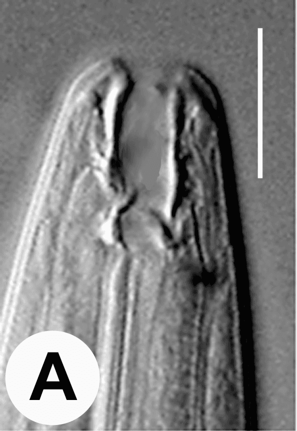 **Modality:** Differential interference contrast (DIC) light microscopy.

**Subject:** Anterior end of a nematode, likely an *Ancylostoma* or *Necator* species (hookworm), viewed from a lateral perspective.

**Key Anatomical Features:**
*   **Buccal Capsule:** A prominent, deep, and sclerotized buccal cavity is visible at the anterior terminus. 
*   **Ventral Cutting Elements:** The image demonstrates the characteristic armature of the oral aperture, showing thickened, tooth-like or plate-like structures (cutting teeth) used for mucosal attachment.
*   **Esophageal Junction:** The posterior base of the buccal capsule transitions into the muscular esophagus, with visible longitudinal striations in the esophageal wall.
*   **Cephalic Structure:** The cuticle appears smooth with subtle longitudinal markings.

**Clinical Significance:** This microscopic view is a primary diagnostic feature for identifying parasitic helminths in clinical samples (e.g., stool concentrates or tissue biopsies). The morphology of the buccal capsule—specifically the shape and number of ventral teeth—is the key taxonomic differentiator between hookworm species that cause human ancylostomiasis and necatoriasis. 

**Scale:** A white vertical scale bar is present in the upper right quadrant for morphometric reference.