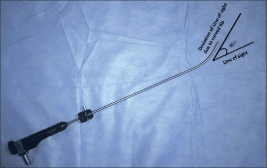 **Imaging Modality:** Clinical photograph of medical instrumentation with schematic annotations.

**Device Classification:** Rigid fiberscope (Bonfils Intubation Fiberscope) designed for airway management and indirect laryngoscopy.

**Technical Specifications and Key Features:**
*   **Shaft Design:** The image displays a long, slender, semi-rigid metallic shaft connected to a handle containing an eyepiece and light source connector.
*   **Distal Configuration:** The distal tip of the scope exhibits a fixed cephalad curvature. 
*   **Optical Alignment:** Annotations indicate a 40-degree deviation of the line of sight relative to the long axis of the shaft. This angulation is specifically designed to facilitate visualization of anteriorly displaced laryngeal structures.
*   **Clinical Application:** Utilized in anesthesia and emergency medicine for "retromolar" intubation techniques or managing patients with difficult airways where direct laryngoscopy is restricted.

**Diagnostic Relevance:** The photograph highlights the characteristic distal angulation that distinguishes this device from standard rigid endoscopes, serving as a key visual cue for its use in overcoming anatomical challenges such as a limited mouth opening or a high-anterior glottis.