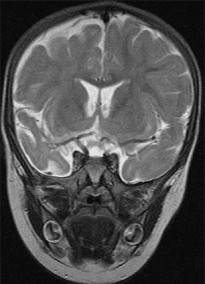 Hugging Face ROCO-Radiology