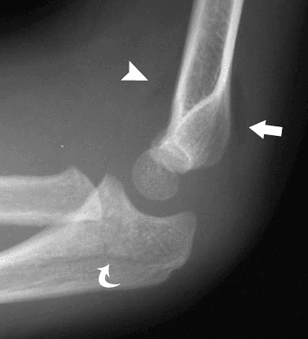 Hugging Face ROCO-Radiology