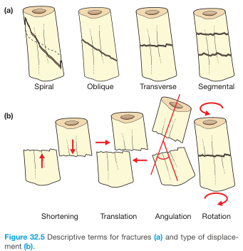 Bailey and Love's Short Practice of Surgery 28th Edition