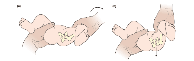 Bailey and Love's Short Practice of Surgery 28th Edition