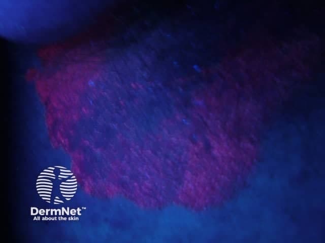 Dermnetnz