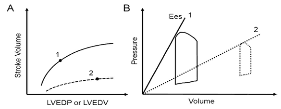 Summary : This figure compares cardiac function under two conditions using two types of plots: (A) the Frank-Starling relationship between stroke volume and left ventricular filling, and (B) pressure-volume loops with end-systolic elastance (Ees) lines.
line and schematic plot:
# Panel A: Frank-Starling Curve :
• Y-axis: Stroke Volume (no units shown).
• X-axis: LVEDP or LVEDV (Left Ventricular End-Diastolic Pressure or Volume; no units shown).
• Two curves are shown:
– Curve 1: Higher, solid line, labeled "1".
– Curve 2: Lower, dashed line, labeled "2".
• Each curve has a point marked (solid dot) on it.
# Panel B: Pressure-Volume Loop and End-Systolic Elastance :
• Y-axis: Pressure (no units shown).
• X-axis: Volume (no units shown).
• Two pressure-volume loops:
– Loop 1: Solid line, larger, leftward, labeled "1".
– Loop 2: Dashed line, smaller, rightward, labeled "2".
• Two Ees (end-systolic elastance) lines:
– Ees 1: Steeper, solid line, labeled "1".
– Ees 2: Less steep, dashed line, labeled "2".
# Design Encodings :
• Solid lines for condition 1, dashed lines for condition 2.
• Dots mark specific points on the curves in panel A.
• Pressure-volume loops are outlined, with loop 2 shown as a dashed outline.
# Analysis :
• Panel A shows that condition 1 (solid line) has a higher stroke volume for any given LVEDP/LVEDV compared to condition 2 (dashed line), indicating better cardiac function.
• Panel B shows that condition 1 has a larger, leftward pressure-volume loop and a steeper Ees line, indicating greater contractility. Condition 2 has a smaller, rightward loop and a less steep Ees line, indicating reduced contractility.
• The figure visually contrasts normal/enhanced versus impaired cardiac function using both stroke volume response and pressure-volume relationships.