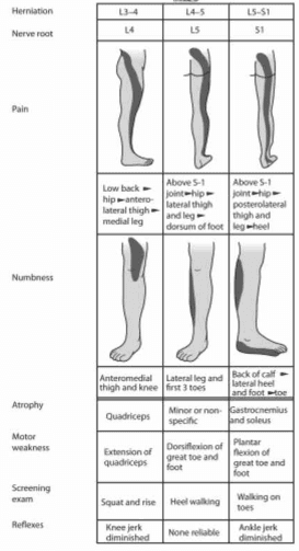Summary : This figure is a comparative chart detailing the clinical features of lumbar disc herniation at three common levels (L3–4, L4–5, L5–S1), including affected nerve roots (L4, L5, S1), pain and numbness distribution, muscle atrophy, motor weakness, screening exams, and reflex changes.
table/chart:
# Herniation Levels and Nerve Roots :
• L3–4 herniation affects L4 nerve root.
• L4–5 herniation affects L5 nerve root.
• L5–S1 herniation affects S1 nerve root.
# Pain Distribution :
• L3–4 (L4): Low back → hip → anterolateral thigh → medial leg.
• L4–5 (L5): Above S-1 joint → hip → lateral thigh and leg → dorsum of foot.
• L5–S1 (S1): Above S-1 joint → hip → posterolateral thigh and leg → heel.
# Numbness Distribution :
• L3–4 (L4): Anteromedial thigh and knee.
• L4–5 (L5): Lateral leg and first 3 toes.
• L5–S1 (S1): Back of calf, lateral heel, and foot/toe.
# Muscle Atrophy :
• L3–4 (L4): Quadriceps.
• L4–5 (L5): Minor or nonspecific.
• L5–S1 (S1): Gastrocnemius and soleus.
# Motor Weakness :
• L3–4 (L4): Extension of quadriceps.
• L4–5 (L5): Dorsiflexion of great toe and foot.
• L5–S1 (S1): Plantar flexion of great toe and foot.
# Screening Exam :
• L3–4 (L4): Squat and rise.
• L4–5 (L5): Heel walking.
• L5–S1 (S1): Walking on toes.
# Reflex Changes :
• L3–4 (L4): Knee jerk diminished.
• L4–5 (L5): None reliable.
• L5–S1 (S1): Ankle jerk diminished.
# Visual Representation :
• Each column includes a diagram showing the typical pain and numbness distribution for the affected nerve root.
# Analysis :
• The chart clearly distinguishes the clinical features of nerve root compression at different lumbar levels.
• Pain and numbness patterns shift from anterolateral (L4) to lateral (L5) to posterolateral (S1) as the herniation level descends.
• Reflex changes and motor weakness are specific to the affected root, aiding in clinical diagnosis.
• Screening exams and muscle atrophy findings provide additional diagnostic clues for localization.