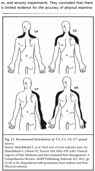Summary : This figure illustrates the dermatomal distribution patterns of the C4, C5, C6, and C7 spinal nerves on the human body, showing the specific skin areas innervated by each nerve root.
illustration:
# Overview :
• Four schematic diagrams of the human upper body (front and back views) are shown, each labeled with a different cervical spinal nerve (C4, C5, C6, C7).
• Each diagram highlights a distinct region of the skin corresponding to the sensory distribution (dermatome) of the respective nerve.
# Dermatome Regions :
• C4:
– Shaded area covers the lower neck, upper shoulder, and extends over the clavicle region.
• C5:
– Shaded area includes the lateral (outer) aspect of the upper arm and shoulder, extending down to just above the elbow.
• C6:
– Shaded area runs from the lateral neck and shoulder, down the lateral arm and forearm, to include the thumb.
• C7:
– Shaded area extends from the posterior neck and shoulder, down the posterior arm and forearm, to include the middle finger.
# Design Encodings :
• Black shading is used to indicate the dermatome for each nerve root on a simplified human outline.
• Each diagram is labeled in the upper left or right with the corresponding nerve root (C4, C5, C6, C7).
# Spatial Relationships :
• The diagrams are arranged in a 2x2 grid, with C4 and C5 on the top row, C7 and C6 on the bottom row.
• Each dermatome is shown on one side of the body for clarity.
# Analysis :
• The figure visually distinguishes the unique, non-overlapping cutaneous territories supplied by each cervical nerve root.
• The C4 dermatome is most superior and medial, while C7 is more posterior and extends to the middle finger.
• The C6 dermatome uniquely includes the thumb, and C5 is limited to the upper lateral arm.
• This layout aids in clinical localization of nerve root pathology based on sensory symptoms.