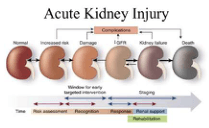 Summary : This figure illustrates the progression of acute kidney injury (AKI) from normal kidney function through increased risk, damage, decreased glomerular filtration rate (↓GFR), kidney failure, and ultimately death. It also highlights the window for early intervention and the stages of clinical management over time.
flowchart:
# Stages of Acute Kidney Injury :
• Normal
• Increased risk
• Damage
• ↓GFR (decreased glomerular filtration rate)
• Kidney failure
• Death
# Complications :
• Arrow labeled "Complications" points from the "Damage" stage to the "↓GFR" stage.
# Intervention and Management Timeline :
• Time axis runs horizontally below the kidney stages.
• Phases labeled: Risk assessment, Recognition, Response, Renal support, Rehabilitation.
• "Window for early targeted intervention" indicated between "Increased risk" and "Damage" stages.
• "Staging" indicated between "↓GFR" and "Kidney failure" stages.
# Design Encodings :
• Kidneys are depicted in a gradient from healthy red (Normal) to dark gray (Death).
• Arrows indicate progression from left (Normal) to right (Death).
• Coloured bars below the timeline represent different phases of clinical management.
# Analysis :
• The figure visually communicates that AKI is a progressive condition with distinct stages, and that early intervention is possible before significant damage occurs.
• The timeline emphasizes the importance of risk assessment and recognition before irreversible kidney failure.
• The colour gradient and arrows reinforce the concept of worsening kidney function over time, culminating in death if not managed.
