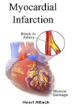 Summary : This illustration explains myocardial infarction (heart attack), showing the anatomical location of a blocked artery and the resulting muscle damage in the heart.
illustration:
Scene Overview :
โข Main subject is a human heart, depicted in color with visible coronary arteries.
โข An inset magnifies a section of an artery, highlighting a blockage (occlusion) within the vessel.
โข The area of muscle damage on the heart is labeled.
โข Text labels include "Myocardial Infarction," "Block in Artery," "Muscle Damage," and "Heart Attack."
โข The color palette uses reds, yellows, and purples to differentiate blood vessels, muscle, and damaged areas.
Technical Details :
โข No scale bar or magnification is provided.
โข The illustration is schematic, not a real photograph or scan.
โข Labels are overlaid directly on the image for clarity.
Spatial Relationships :
โข The blocked artery is shown in close-up in the inset, with a clear connection to the affected region of the heart muscle.
โข The muscle damage is localized to a specific area of the heart, corresponding to the blocked artery.
Analysis :
โข The figure visually links a blocked coronary artery to localized muscle damage in the heart, illustrating the pathophysiology of myocardial infarction (heart attack).
โข The inset clarifies the cause (arterial blockage) and its effect (muscle damage), supporting understanding of the condition.