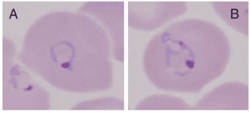 Summary : This figure shows two microscopic images (labeled A and B) of red blood cells infected with a parasite, likely Plasmodium species, stained to highlight intracellular structures.
photo:
Scene Overview :
• Main subject: Red blood cells each containing a single intracellular parasite.
• Setting: Microscopy, likely brightfield with Giemsa or similar stain.
• Perspective: Close-up, high magnification, single-cell focus.
• Composition: Two panels (A and B), each showing a single infected erythrocyte centrally placed.
• Lighting: Even, typical of transmitted light microscopy.
• Colour palette: Pale pink cytoplasm, purple-blue parasite structures.
Technical Details :
• No visible scale bar or magnification indicator.
• Staining: Parasite nuclei and cytoplasm stained purple/blue, host cell cytoplasm pale pink.
• On-image text: Labels “A” (left) and “B” (right) in black font at the upper left and right corners, respectively.
Spatial Relationships :
• Foreground: Infected erythrocytes with visible ring- or amoeboid-shaped parasites.
• Background: Out-of-focus neighboring erythrocytes.
• Placement: Each panel centers a single infected cell.
Analysis :
• Both panels show red blood cells with intracellular parasites at similar developmental stages, possibly ring or trophozoite forms.
• The parasites are characterized by a purple chromatin dot and a lighter blue cytoplasmic ring or amoeboid structure.
• The images may be used to compare morphological differences or diagnostic features between two conditions, stains, or parasite species.