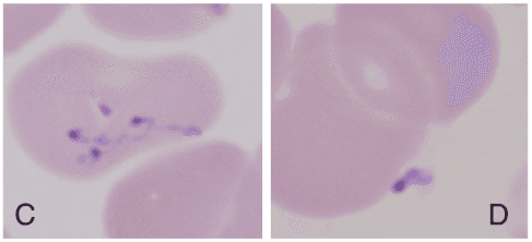 Summary : This figure shows two microscopy images (labeled C and D) of stained blood cells, highlighting the presence of small, dark-stained structures within or near the cells.
photo:
Scene Overview :
• Two side-by-side light microscopy images of blood smears, labeled "C" (left) and "D" (right).
• Main subjects are red blood cells with small, dark purple/blue-stained inclusions or organisms visible in the cytoplasm or adjacent to the cells.
• Background is pale pink, typical of Giemsa or Wright’s stain.
• The images are slightly out of focus, but the inclusions are clearly visible.
Technical Details :
• No visible scale bar or magnification indicator.
• Staining method appears to be a standard hematological stain (e.g., Giemsa/Wright).
• No on-image UI elements or additional text besides the labels "C" and "D" in the lower left and right corners, respectively.
Spatial Relationships :
• In image C, multiple inclusions are present within a single red blood cell, some connected by fine thread-like structures.
• In image D, a single inclusion is seen near the edge of a red blood cell.
• Both images focus on the central area of the field, with cells partially overlapping.
Analysis :
• The images likely compare two different morphological forms or stages of an intraerythrocytic organism (e.g., a blood parasite such as Plasmodium or Babesia).
• Image C shows a more complex or segmented form, while image D shows a simpler, possibly single-nucleated form.
• The visual differences suggest a comparison of developmental stages, species, or treatment effects on the organisms within red blood cells.