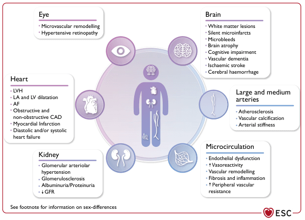 Summary : This figure illustrates the organ-specific and vascular effects of hypertension, detailing pathological changes in the eye, heart, kidney, brain, large and medium arteries, and microcirculation. Each organ system is listed with its associated hypertensive complications.
diagram:
# Organ Systems and Hypertensive Effects :
## Eye :
• Microvascular remodelling
• Hypertensive retinopathy
## Heart :
• LVH (left ventricular hypertrophy)
• LA and LV dilatation (left atrial and left ventricular)
• AF (atrial fibrillation)
• Obstructive and non-obstructive CAD (coronary artery disease)
• Myocardial infarction
• Diastolic and/or systolic heart failure
## Kidney :
• Glomerular arteriolar hypertension
• Glomerulosclerosis
• Albuminuria/Proteinuria
• ↓ GFR (glomerular filtration rate)
## Brain :
• White matter lesions
• Silent microinfarcts
• Microbleeds
• Brain atrophy
• Cognitive impairment
• Vascular dementia
• Ischaemic stroke
• Cerebral haemorrhage
## Large and Medium Arteries :
• Atherosclerosis
• Vascular calcification
• Arterial stiffness
## Microcirculation :
• Endothelial dysfunction
• ↑ Vasoreactivity
• Vascular remodelling
• Fibrosis and inflammation
• ↑ Peripheral vascular resistance
# Layout :
• Central human figure with icons representing each organ system.
• Each organ system is connected to a text box listing its hypertensive complications.
• Colour-coded circles and boxes for each organ/vascular system.
# Additional Information :
• Footnote mentions sex-differences (not detailed in the figure).
• ESC (European Society of Cardiology) logo at the bottom right.
# Analysis :
• The figure demonstrates that hypertension affects multiple organ systems, with distinct pathological changes in each.
• Both macrovascular (large arteries) and microvascular (small vessels, microcirculation) complications are highlighted.
• The heart, brain, and kidney are shown to be particularly vulnerable, with a wide range of structural and functional consequences.
• The diagram visually emphasises the systemic nature of hypertensive disease and its multi-organ impact.