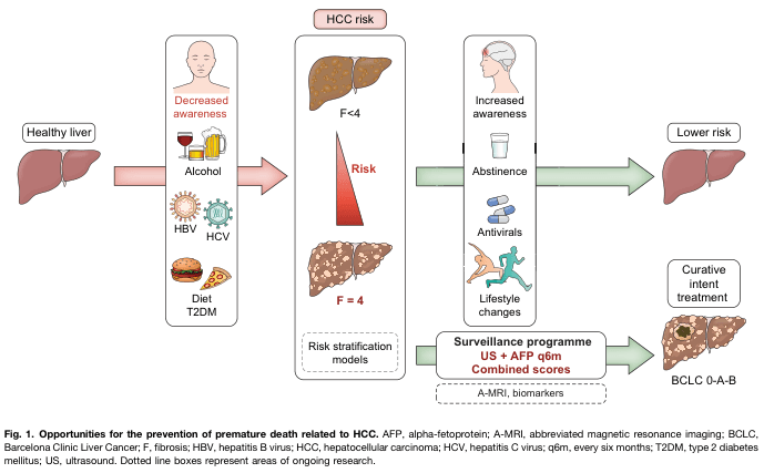 Management of Hepatocellular Carcinoma