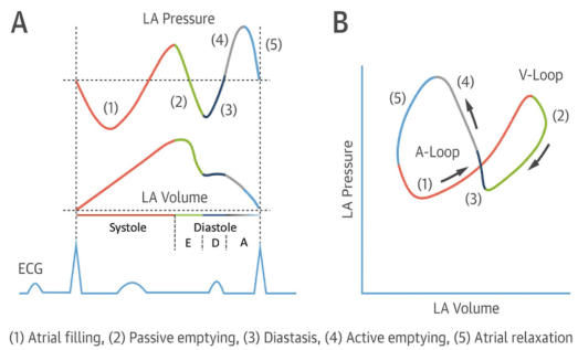 Summary : This figure illustrates the left atrial (LA) pressure-volume relationship during the cardiac cycle, showing both time-course traces and a pressure-volume loop, with key phases of atrial function annotated and correlated with the ECG.
line plot and loop diagram:
# Panel A: LA Pressure and Volume Traces
• Top trace: LA Pressure (y-axis, arbitrary units) over time.
• Middle trace: LA Volume (y-axis, arbitrary units) over time.
• Bottom trace: ECG waveform for temporal reference.
• X-axis: Cardiac cycle phases, with systole and diastole labeled; diastole further subdivided into E, D, and A phases.
• Five phases are color-coded and numbered:
– (1) Atrial filling (red)
– (2) Passive emptying (green)
– (3) Diastasis (black)
– (4) Active emptying (blue)
– (5) Atrial relaxation (gray)
• Vertical dashed lines demarcate transitions between phases.
# Panel B: LA Pressure-Volume Loop
• X-axis: LA Volume (arbitrary units).
• Y-axis: LA Pressure (arbitrary units).
• The loop is traced in a counterclockwise direction, with arrows indicating the sequence.
• The same five phases (1–5) are color-coded as in Panel A.
• The loop is divided into two segments: A-Loop (phases 1, 3, 4, 5) and V-Loop (phase 2).
# Design Encodings :
• Distinct colors for each phase (red, green, black, blue, gray).
• Arrows on the loop indicate the direction of the cardiac cycle.
• ECG trace provides timing reference for the pressure and volume changes.
# Analysis :
• The LA pressure and volume traces show cyclical changes corresponding to atrial filling, emptying, and relaxation.
• The pressure-volume loop visually summarizes the dynamic relationship between LA pressure and volume, with distinct segments for passive and active phases.
• The figure highlights the temporal coordination between atrial events and the ECG, emphasizing the mechanical and electrical coupling in the cardiac cycle.