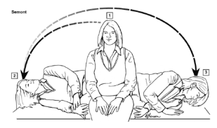 Summary : This illustration demonstrates the Semont maneuver, a physical therapy technique used to treat benign paroxysmal positional vertigo (BPPV) by repositioning canaliths in the inner ear.
illustration:
# Scene Overview :
• The sequence shows a person sitting on an examination table, then quickly moving to lie on one side, and then to the opposite side.
• Three positions are depicted:
1. Sitting upright in the center of the table.
2. Lying on the left side with the head turned upward.
3. Lying on the right side with the head turned downward.
• Arrows indicate the direction of movement from the sitting position to each side.
# Technical Details :
• The illustration is labeled "Semont" in the upper left.
• The person is wearing a vest over a shirt and pants.
• No scale bar or measurement units are present.
• The sequence is shown with dashed and solid arrows to indicate the order of movements.
# Spatial Relationships :
• The person starts in the center, moves rapidly to one side, then to the other, maintaining a consistent orientation of the torso and head as indicated by the arrows.
• The table is depicted horizontally, with the person’s movements spanning from left to right.
# Analysis :
• The illustration clearly outlines the three-step Semont maneuver, emphasizing the rapid, sequential movement from sitting to lying on one side, then quickly to the other.
• The arrows and body positions visually guide the viewer through the maneuver, making it suitable for patient or clinician education.
