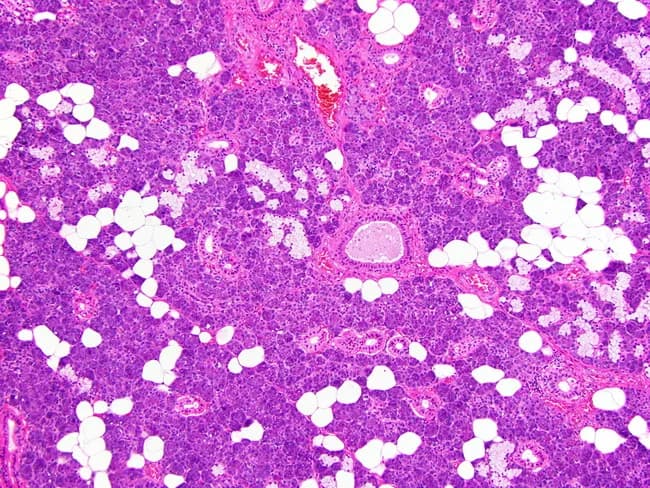 This histology image shows a hematoxylin and eosin stained paraffin-embedded section of human submandibular gland tissue, examined by light microscopy at high power. The gland demonstrates mixed seromucinous acini in which mucous cells form the central portions of the acini and serous cells lie at the periphery, with serous demilunes sometimes evident at mucous borders. Excretory and intercalated ducts are readily visible within the lobular architecture, appearing as columnar to cuboidal ductal elements with clear lumens. The acini are small to medium in size, and the surrounding stroma contains adipose tissue along with delicate connective tissue septa that partition the lobules. The overall pattern reflects normal salivary gland histology without overt cytologic atypia, notable inflammatory infiltrate, or neoplastic change in this field. Clinically, this image is pertinent for education on glandular microanatomy, including acinar polarity (serous periphery vs mucous center), ductal morphology, and the relationship between acini and excretory ducts. It supports differential considerations such as normal variant anatomy, sialadenitis, and salivary gland neoplasms in comparative studies. The image is a valuable teaching tool for pathologists, residents, and students to recognize typical histologic landmarks and enhance reproducibility in diagnostic reporting.
