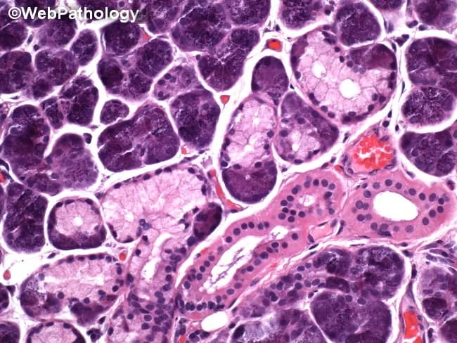 Histology micrograph of human pancreatic tissue analyzed by brightfield light microscopy after Hematoxylin and Eosin staining. The specimen shows classic lobular exocrine pancreas with densely packed acinar cells and intervening islets of Langerhans. Acinar cells display basophilic cytoplasm, basally located round nuclei, and granular eosinophilic zymogen content, contributing to the characteristic purple-blue cellular nests on the slide. The lobular architecture is preserved, with clear separation by connective septa. Within the ducts, cuboidal to low columnar epithelium lines the ductal lumina; small interlobular ducts are visible as white-staining channels. Vascular structures are present, containing erythrocytes. Adipose tissue is variably present at the periphery, consistent with normal pancreatic parenchyma. Notable features include the pale-staining islets that contrast with the intensely staining acinar lobules, providing a focal example of endocrine-exocrine juxtaposition. No overt inflammatory infiltrate, edema, necrosis, or fibrotic changes are evident in this field. Clinically, this image serves as a reference for normal pancreatic histology and as a teaching aid in pathology education. Potential diagnostic uses include benchmarking against pancreatopathic states such as pancreatitis or neoplasia, and facilitating differential diagnosis discussions in exam questions and research reviews. This image supports multiple learning modalities, including atlas reference, slide review, and examination preparation resources.